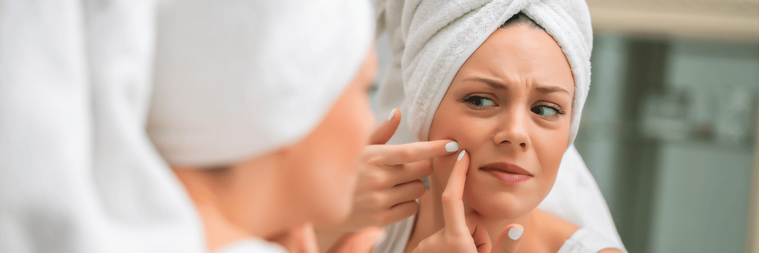 Here are 8 easy steps to cure pimples at home naturally: - Cosmosentials