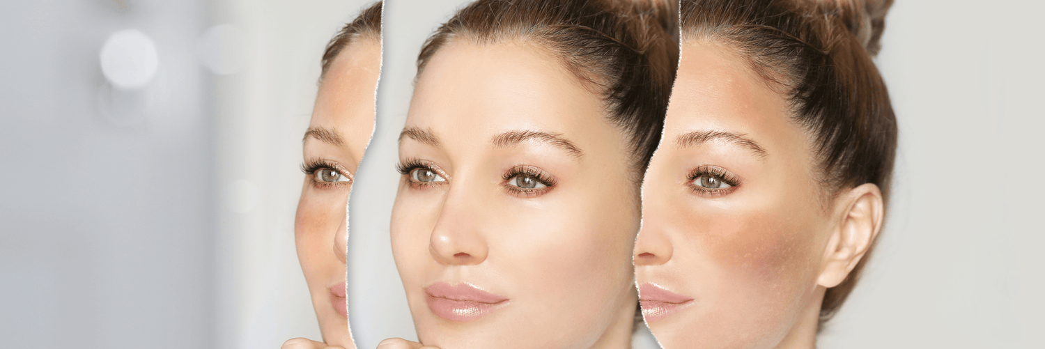 Hyperpigmentation & Dark Spots: Causes, Treatments & Best Products - Cosmosentials