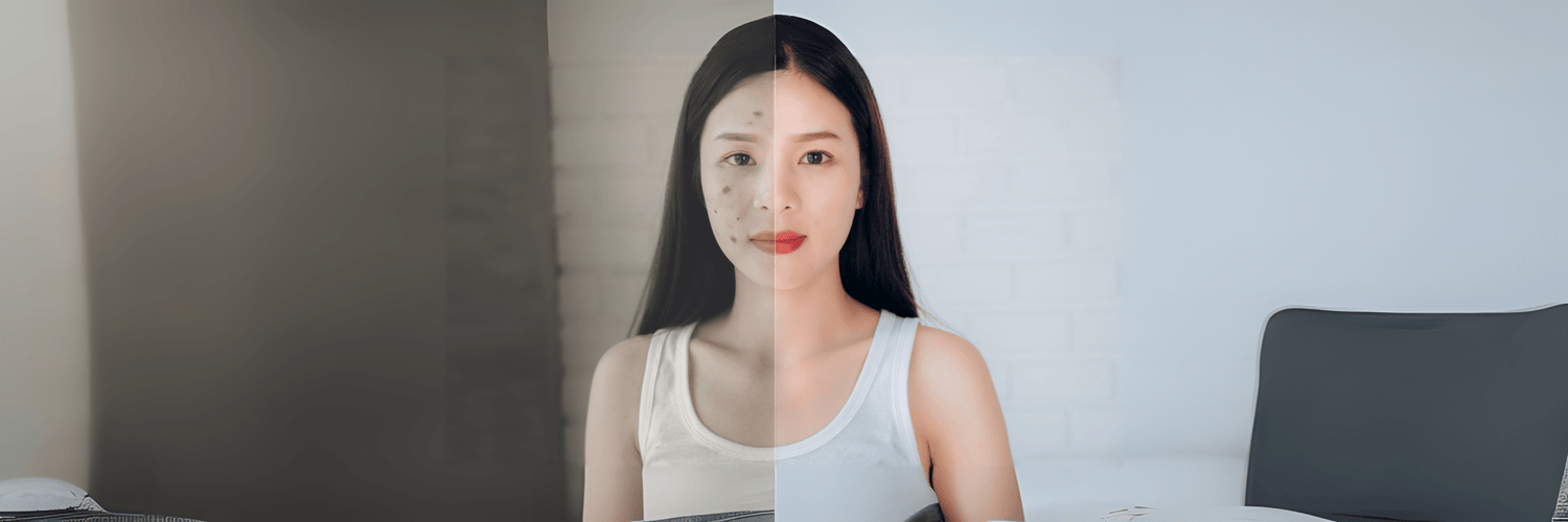 Say Goodbye to Acne: Effective Products That Actually Work - Cosmosentials