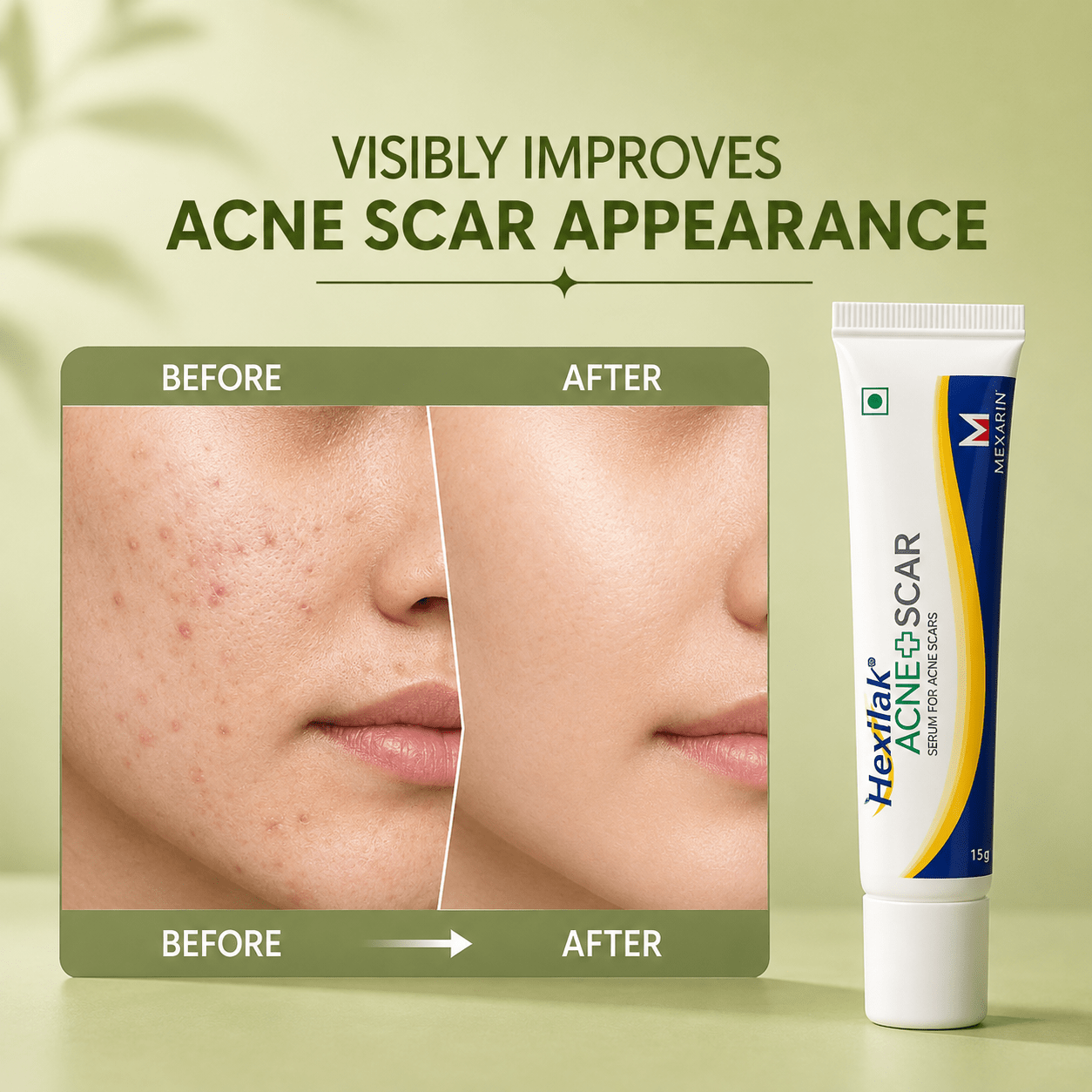 Hexilak Acne + Scar Serum / Gel - Cosmosentials