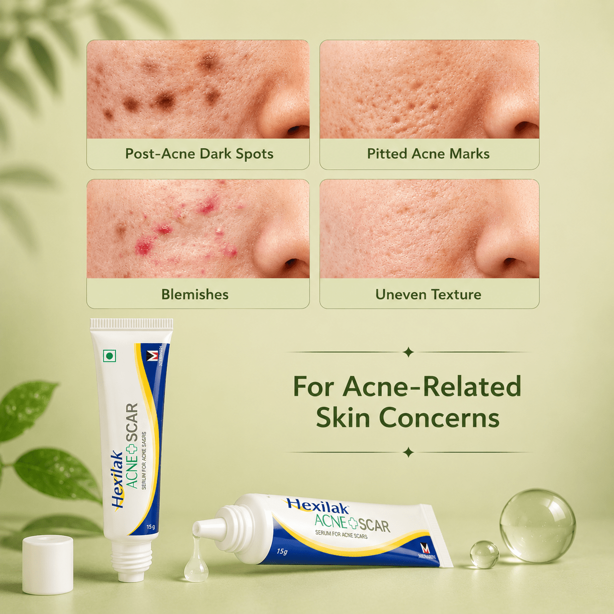 Hexilak Acne + Scar Serum / Gel - Cosmosentials