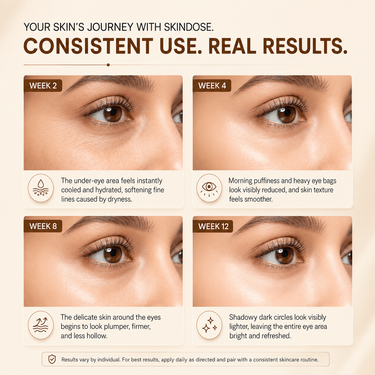 Yuvenex Under Eye Gel 25ml - Cosmosentials